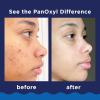 imagePanOxyl Acne Foaming Wash Benzoyl Peroxide 10 Maximum Strength Antimicrobial 55 Oz55 Ounce Pack of 1
