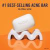 imagePanOxyl Acne Treatment Bar with 10 Benzoyl Peroxide Maximum Strength Bar Soap for Face Body Chest and Back Benzoyl Peroxide Soap Body Wash Vegan For Acne Prone Skin 4 oz 1 Bar